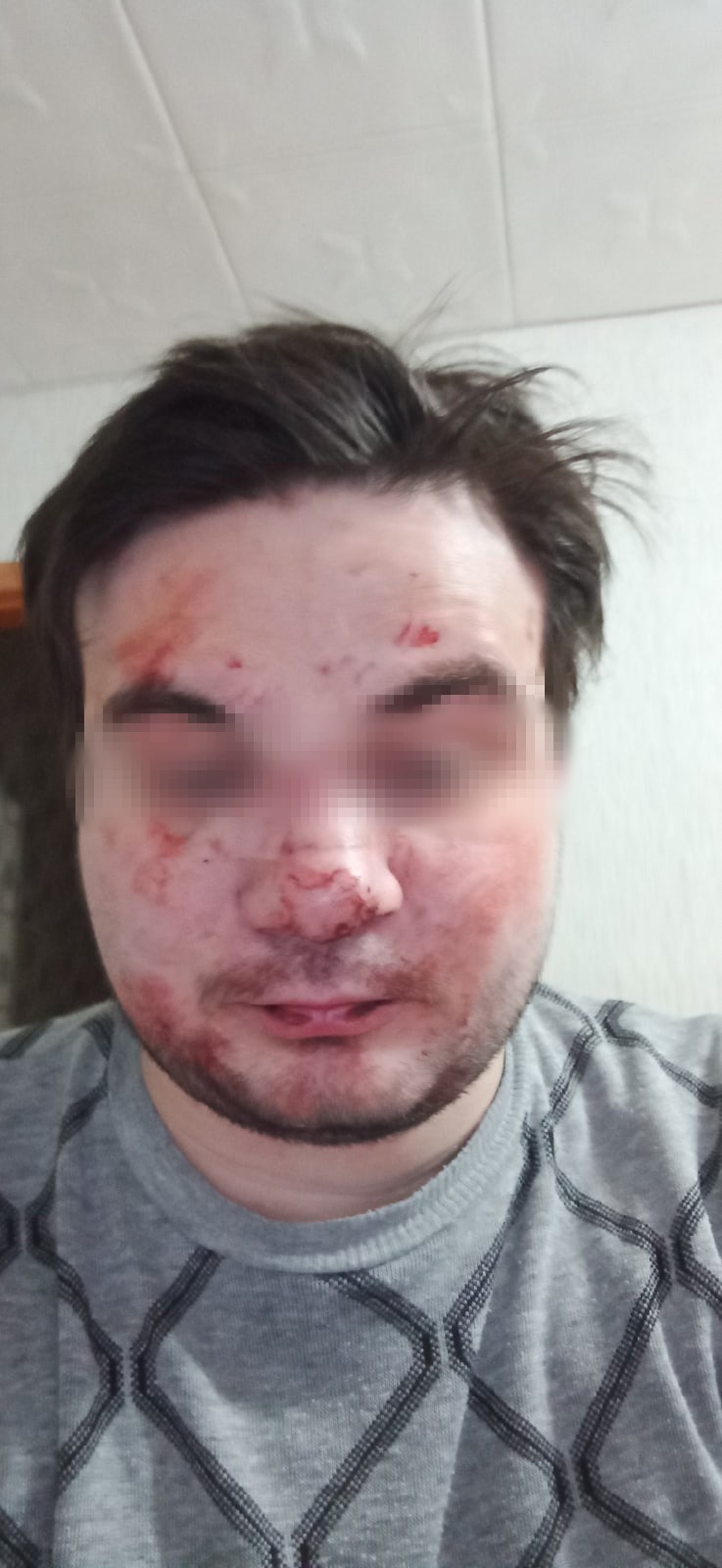 В Тверской области мужчина искал магазин и нарвался на драку В Тверской области мужчина искал магазин и нарвался на драку