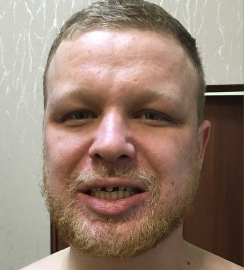 В Тверской области ищут возможных жертв молодого насильника