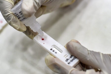 Минздрав прокомментировал требование сдавать платно ПЦР-тесты для госпитализации