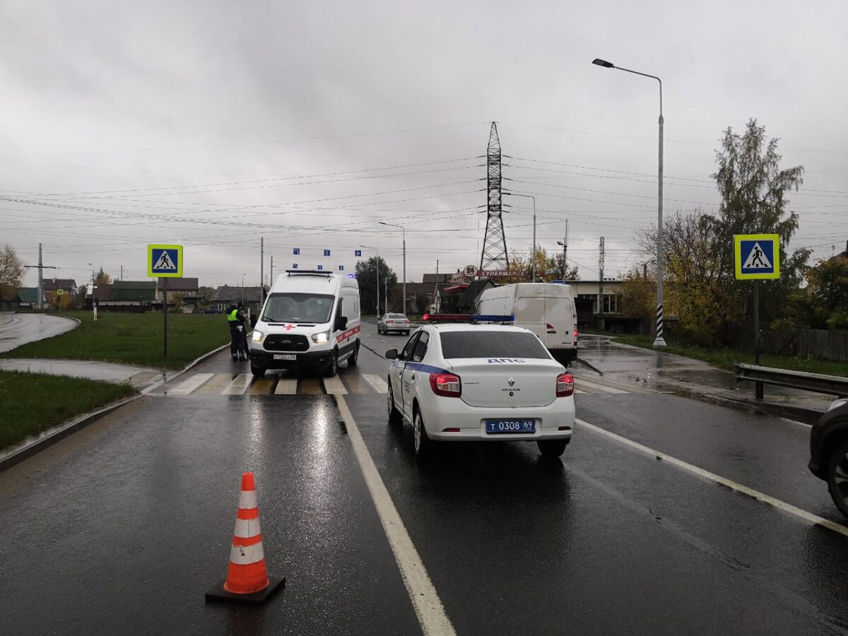 В Твери пешеход получил серьезные травмы под колесами иномарки