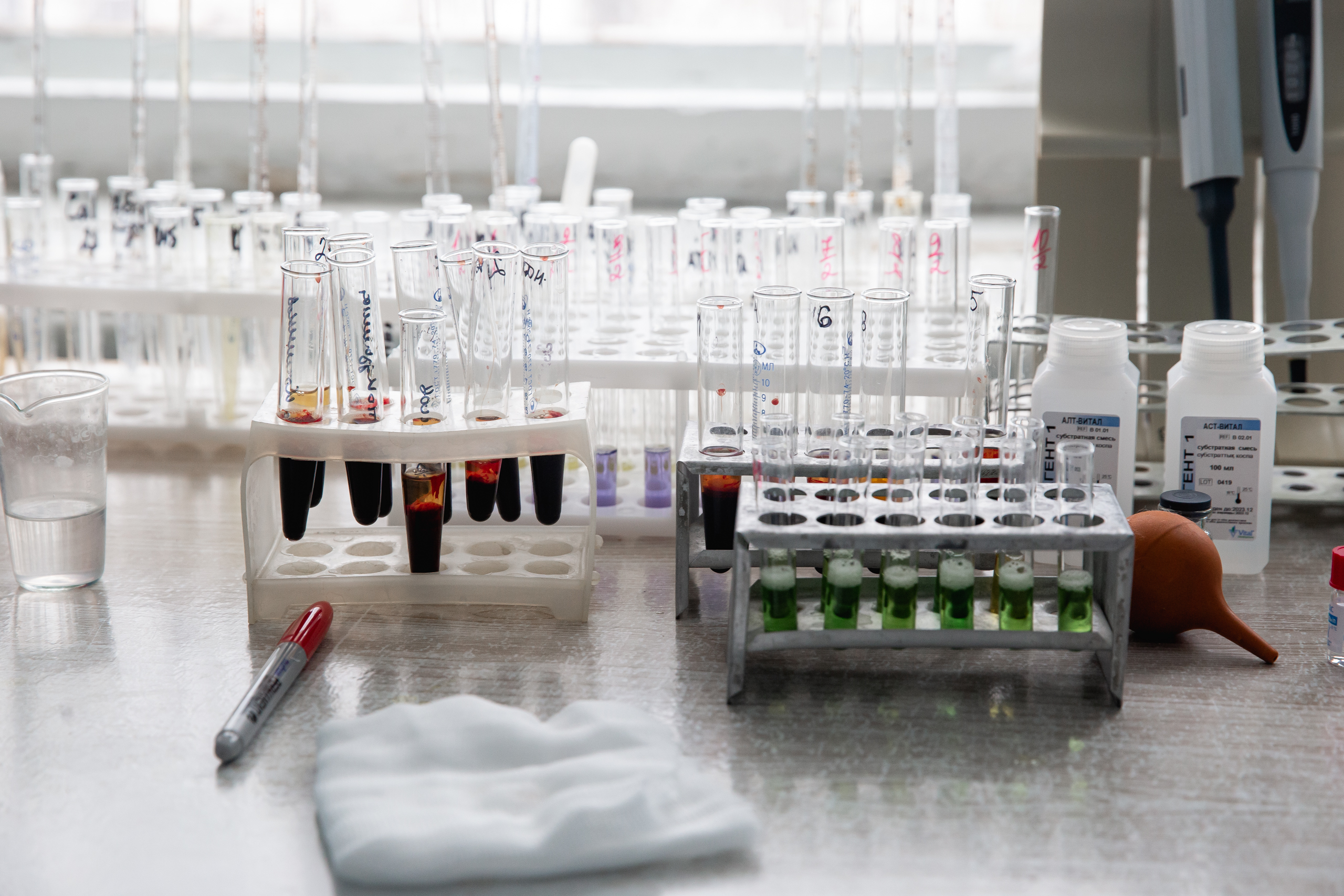 Врач назвала симптомы густоты крови и рассказала, чем это опасно