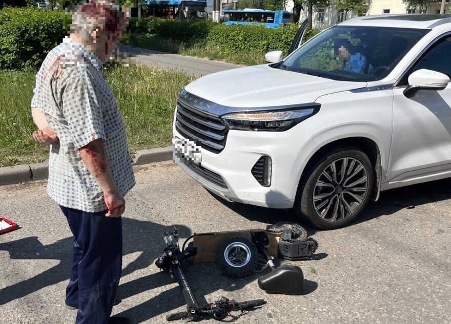 Самокатчик попал в больницу после столкновения с китайским кроссовером в Твери Самокатчик попал в больницу после столкновения с китайским кроссовером в Твери
