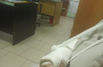 На берегу Волги в Твери мужчина покалечил незнакомую ему женщину