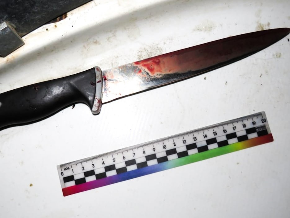 Жительница Тверской области чудом выжила во время ссоры с москвичом 