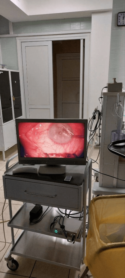 В Тверской области впервые провели сложную операцию на глазах