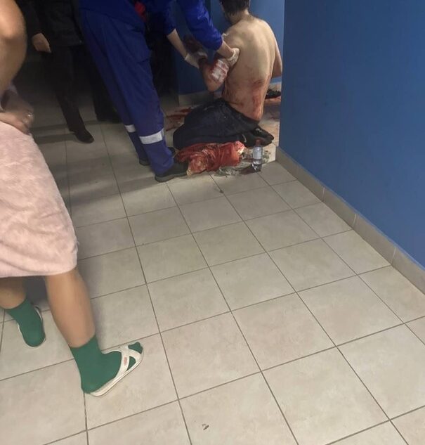 В Твери медики и полиция прибыли к залитому кровью подъезду В Твери медики и полиция прибыли к залитому кровью подъезду
