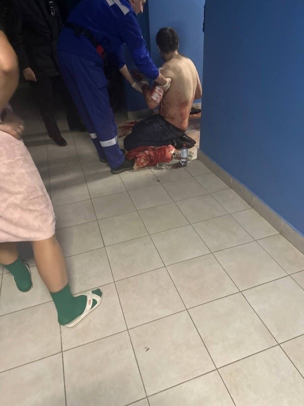 В Твери медики и полиция прибыли к залитому кровью подъезду В Твери медики и полиция прибыли к залитому кровью подъезду