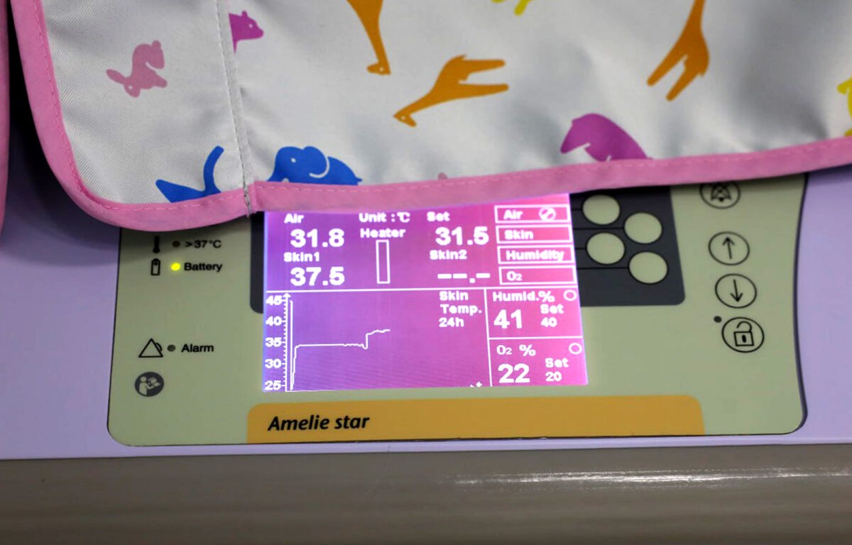 В Тверском областном перинатальном центре появилась уникальная техника 