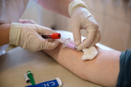 Врач рассказал жителям Тверской области, какие анализы сдавать бесполезно