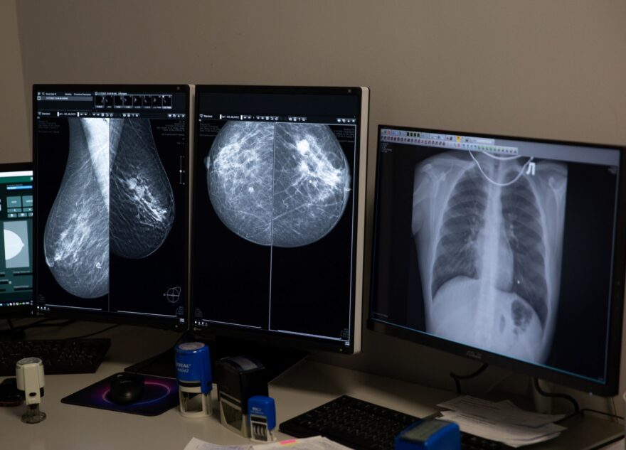 Врач-онколог назвал самые опасные мифы о раке