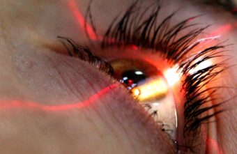 Врачи назвали причину ухудшения зрения весной Врачи назвали причину ухудшения зрения весной