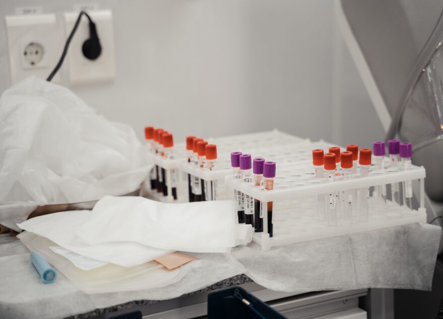 Жители Твери могут сдать кровь в помощь пострадавшим при теракте в «Крокусе»  