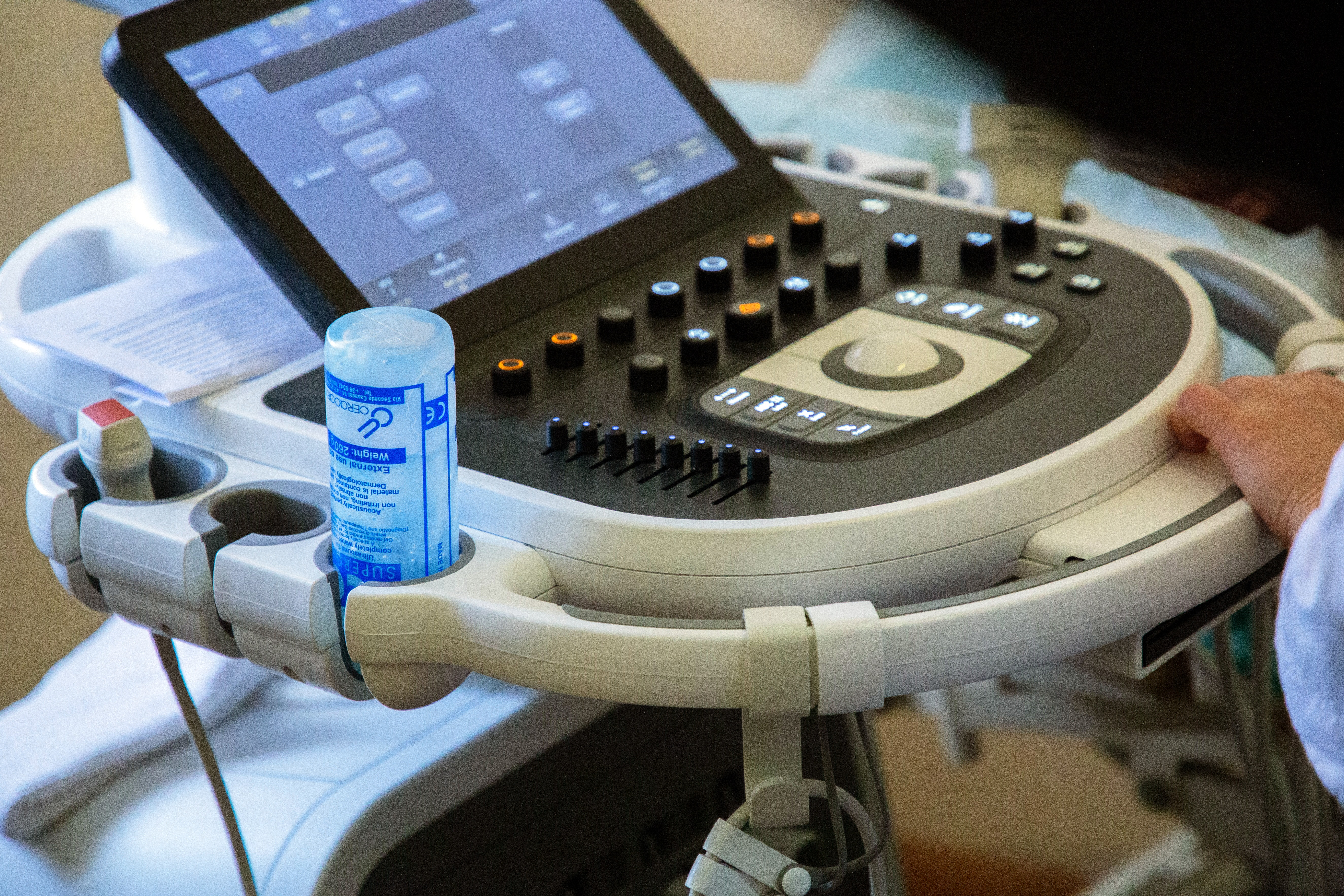 Роддом в Твери заставили приобрести оборудование для УЗИ