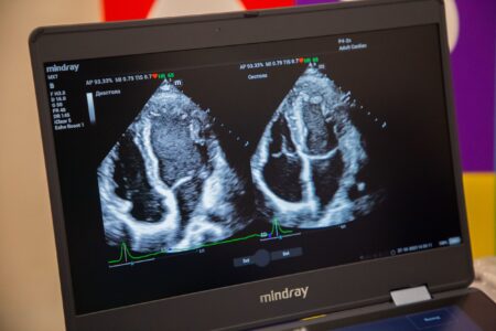 Врач рассказала, чего никогда не покажет УЗИ Врач рассказала, чего никогда не покажет УЗИ