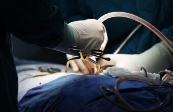 В Брянске женщина умерла после операции у врача из Твери