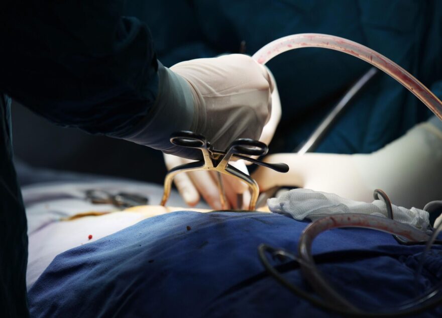 В Брянске женщина умерла после операции у врача из Твери