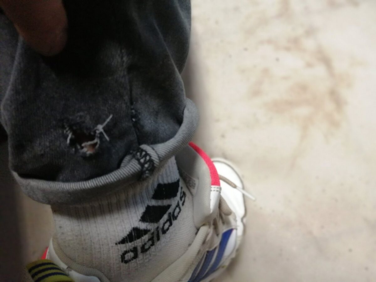 Жителя Тверской области укусила собака, которую все защищают Жителя Тверской области укусила собака, которую все защищают