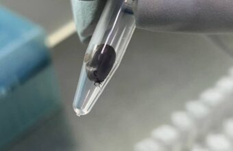 В тверском медцентре обнаружили 9 клещей с боррелиозом В тверском медцентре обнаружили 9 клещей с боррелиозом