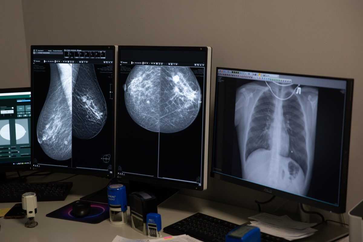 Онколог рассказал, в каком возрасте нужно всем провериться на рак