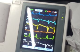 Медики Тверской скорой медицинской помощи подарили женщине вторую жизнь Медики Тверской скорой медицинской помощи подарили женщине вторую жизнь