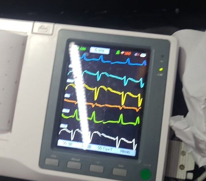 Медики Тверской скорой медицинской помощи подарили женщине вторую жизнь