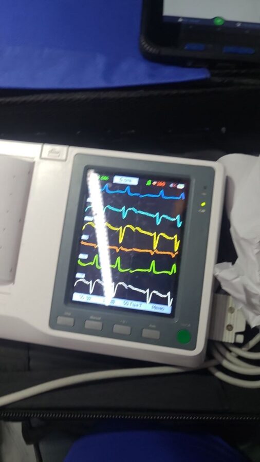 Медики Тверской скорой медицинской помощи подарили женщине вторую жизнь