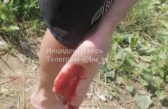 Жители Твери поранили ноги во время купания в Волге