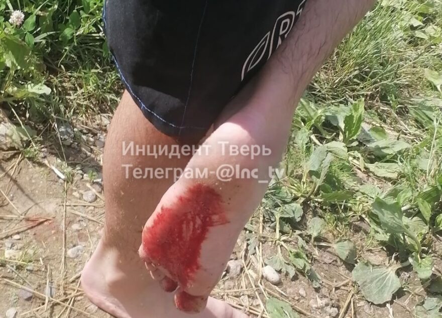 Жители Твери поранили ноги во время купания в Волге