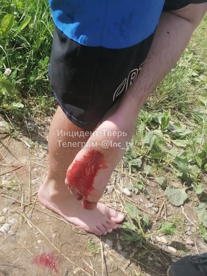 Жители Твери поранили ноги во время купания в Волге Жители Твери поранили ноги во время купания в Волге