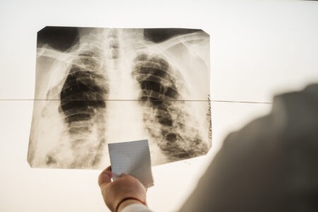 За неправильные диагнозы российские поликлиники будут штрафовать