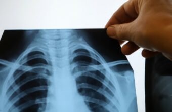 Пожилым людям Тверской области рассказали, как сохранить здоровые легкие