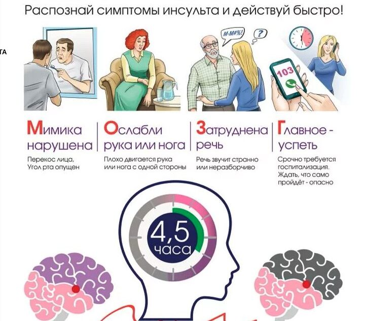 В День борьбы с инсультом жителей Тверской области призывают следить за своим здоровьем 