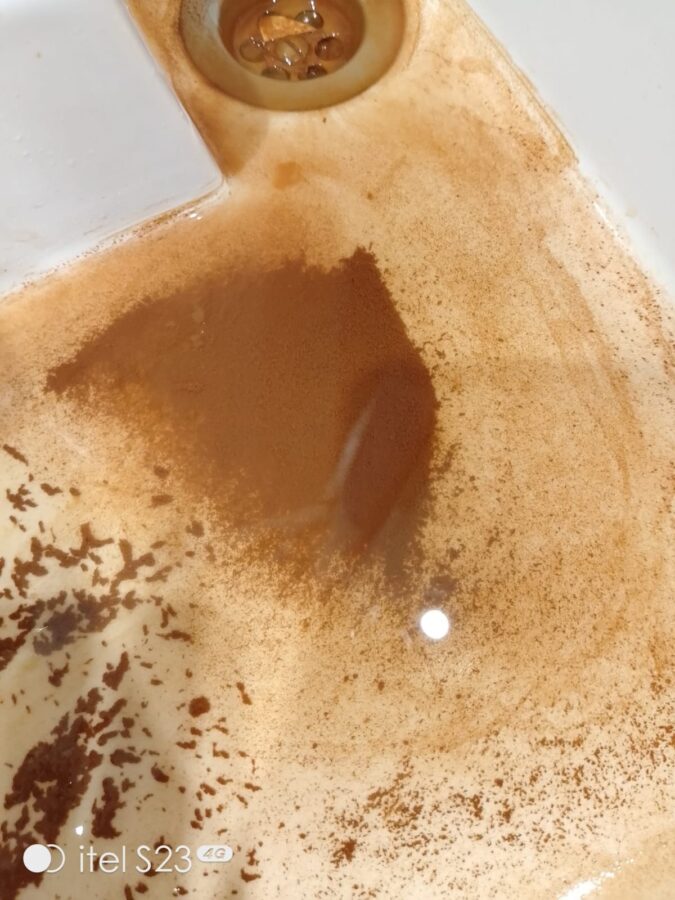 Из-за ржавой воды у жителей Тверской области начались серьезные проблемы с кожей