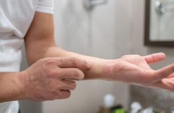 Через одежду жители Тверской области могут заразиться опасными заболеваниями Через одежду жители Тверской области могут заразиться опасными заболеваниями