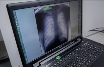 Врач предупредил, что грязный воздух в отопительный сезон вызывает ХОБЛ Врач предупредил, что грязный воздух в отопительный сезон вызывает ХОБЛ