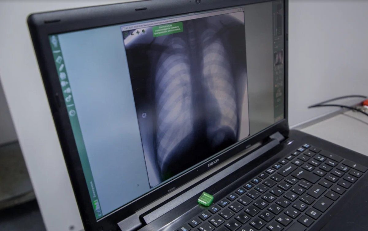 Врач предупредил, что грязный воздух в отопительный сезон вызывает ХОБЛ