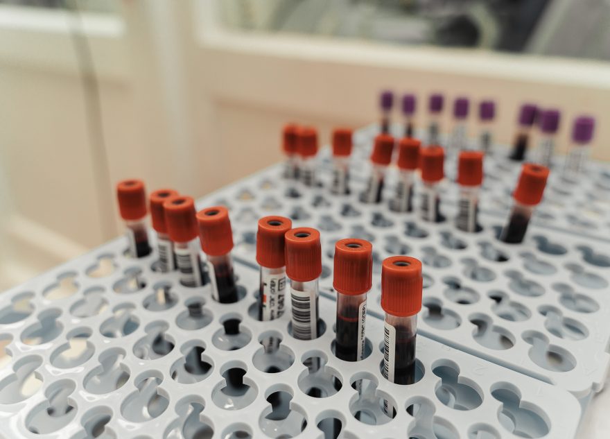 Врач рассказал, как проявляется дефицит железа