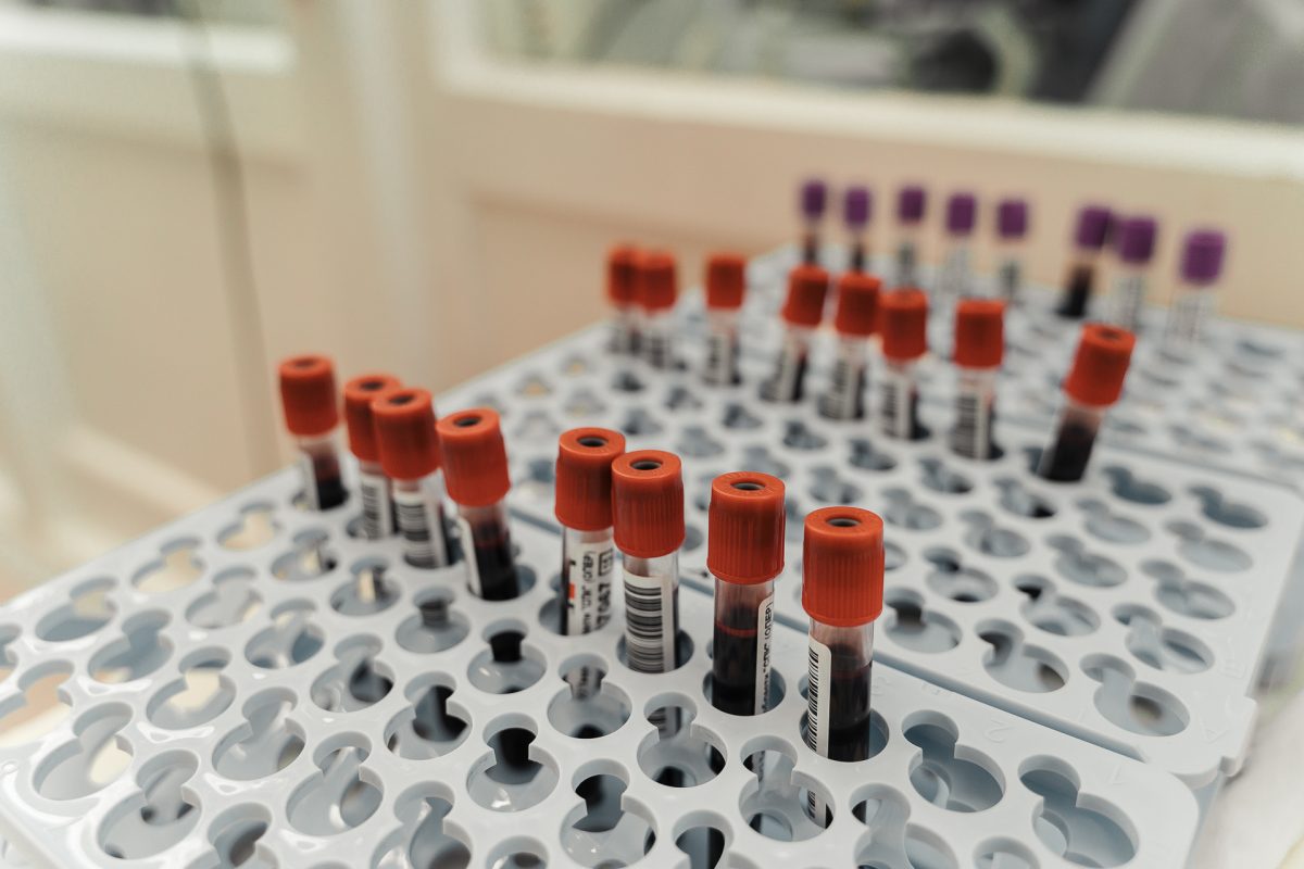 Врач рассказал, как проявляется дефицит железа Врач рассказал, как проявляется дефицит железа