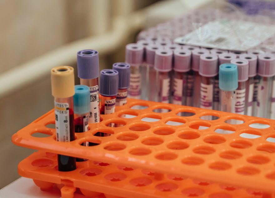 Врач рассказал, как сэкономить на сдаче анализов