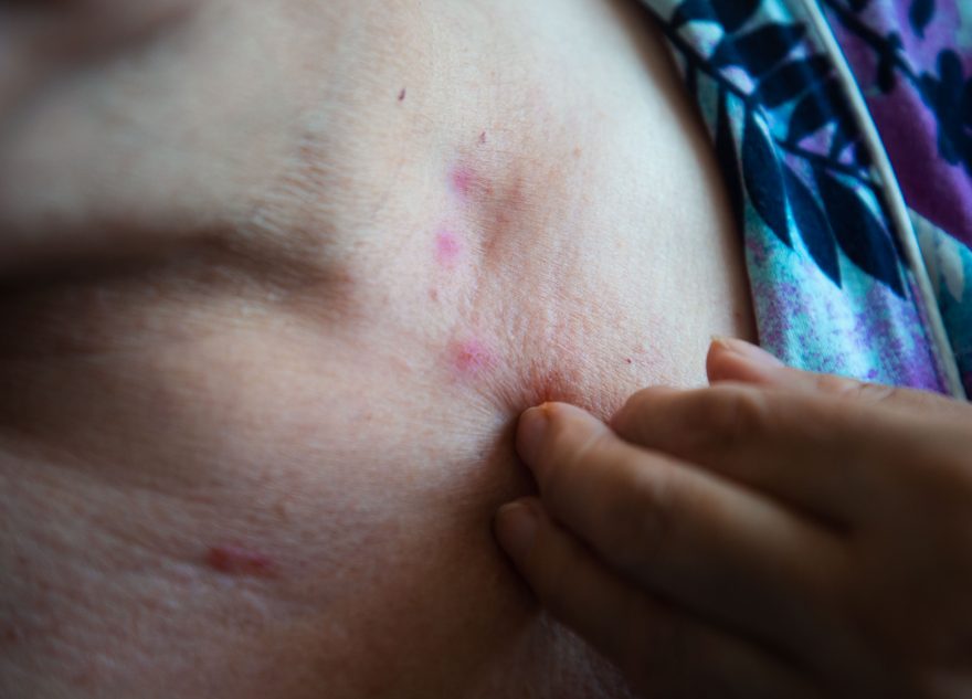 В мае Тверскую область ждет нашествие комаров