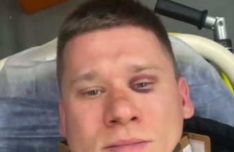 Известный фотограф рассказал подробности своего избиения в Твери фотограф