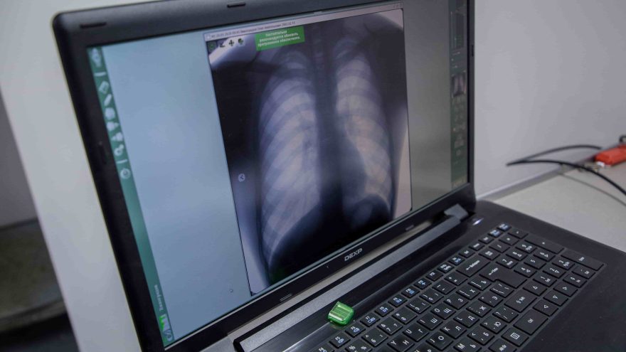 флюорографическое