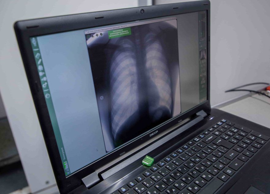 флюорографическое