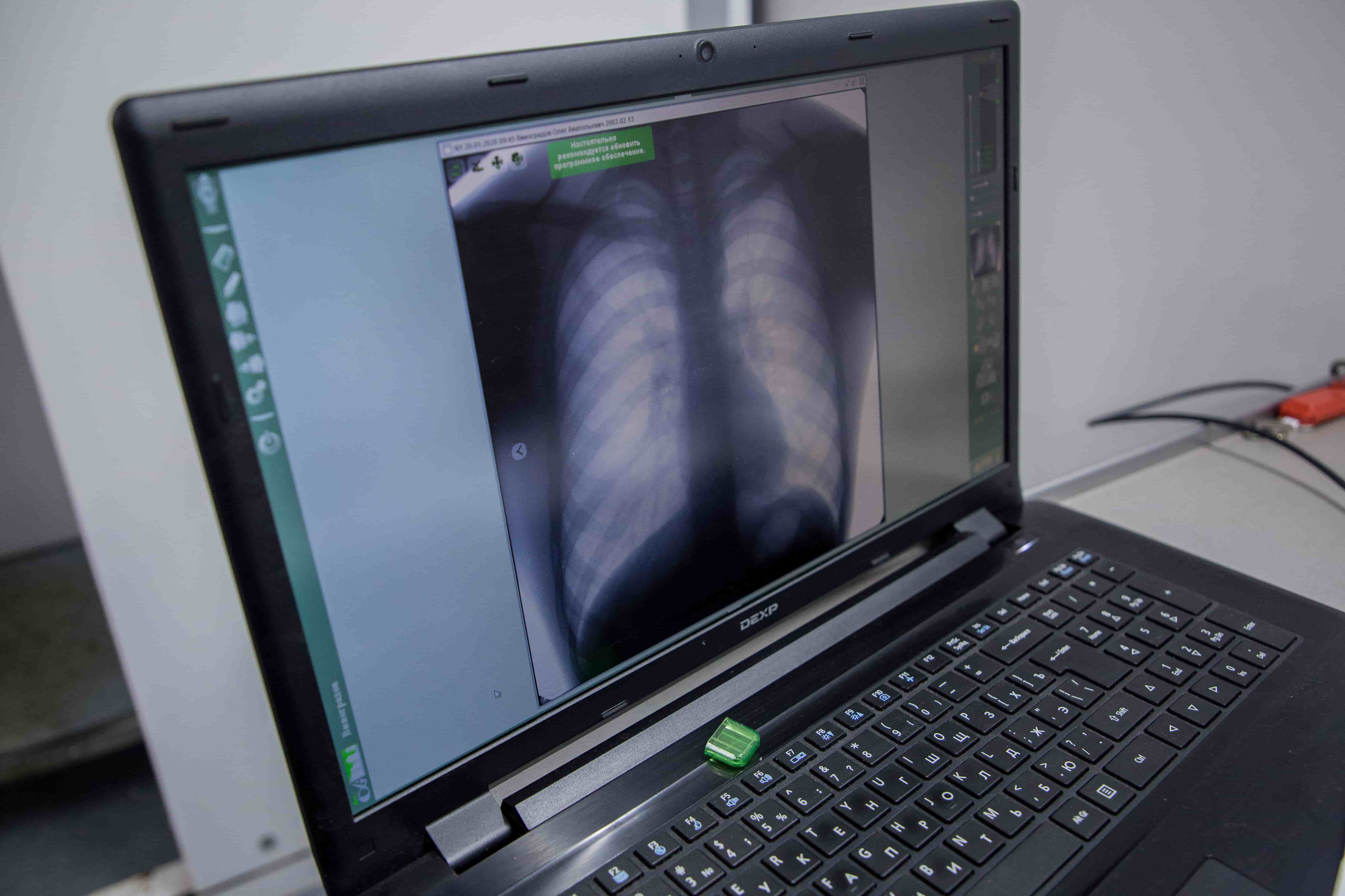 флюорографическое